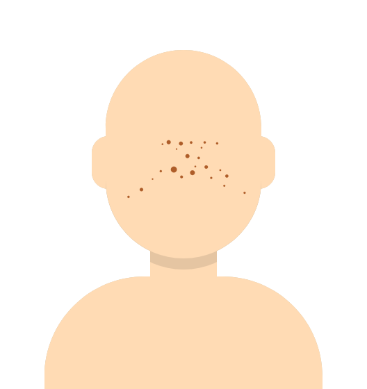 body10